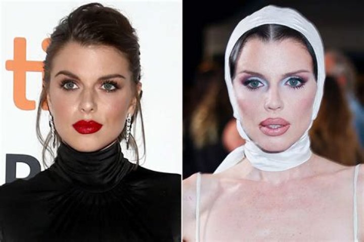 A Deep Dive Into Her Pre-Surgery Appearance