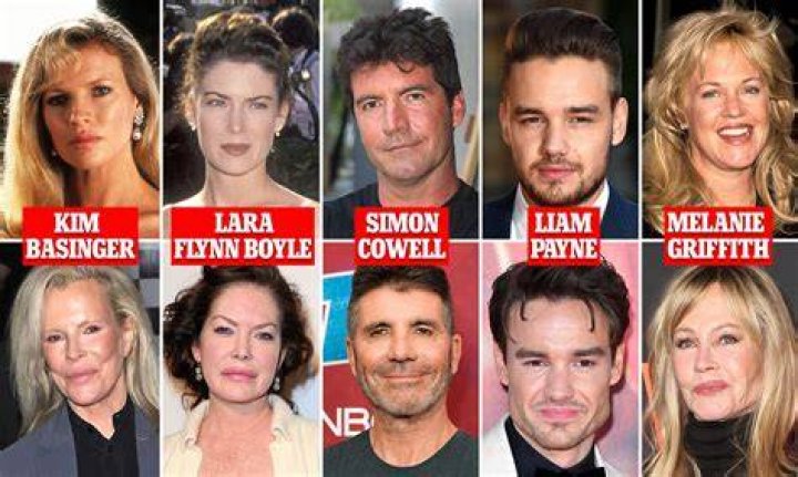 Did Clea Shearer Have Plastic Surgery? Facts To Know About The Reality TV Star
