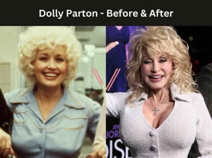 Dolly Parton's Boobs: Uncovering The Secrets And Impact Of An Icon