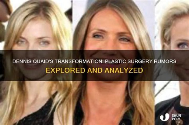 Has Dennis Quaid Embraced Plastic Surgery?