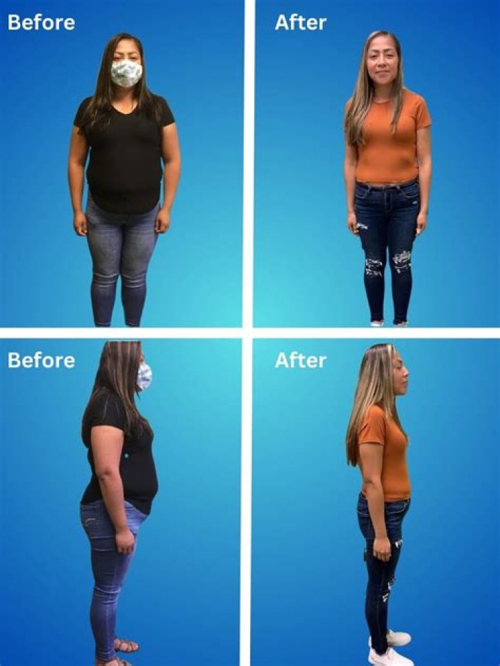 Jacksonville Semaglutide Weight Loss Clinic in Florida