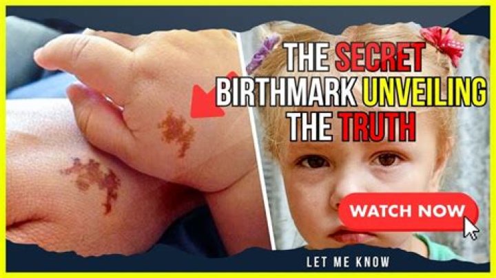 Jacob Elordi's Birthmark: Unveiling Hidden Secrets And Fascinating Truths