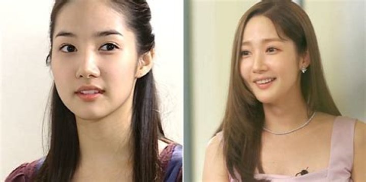 Park Min Young's Surgery: Unlocking Beauty's Secrets