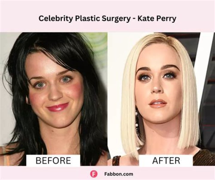 Plastic Surgery Before And After Insights