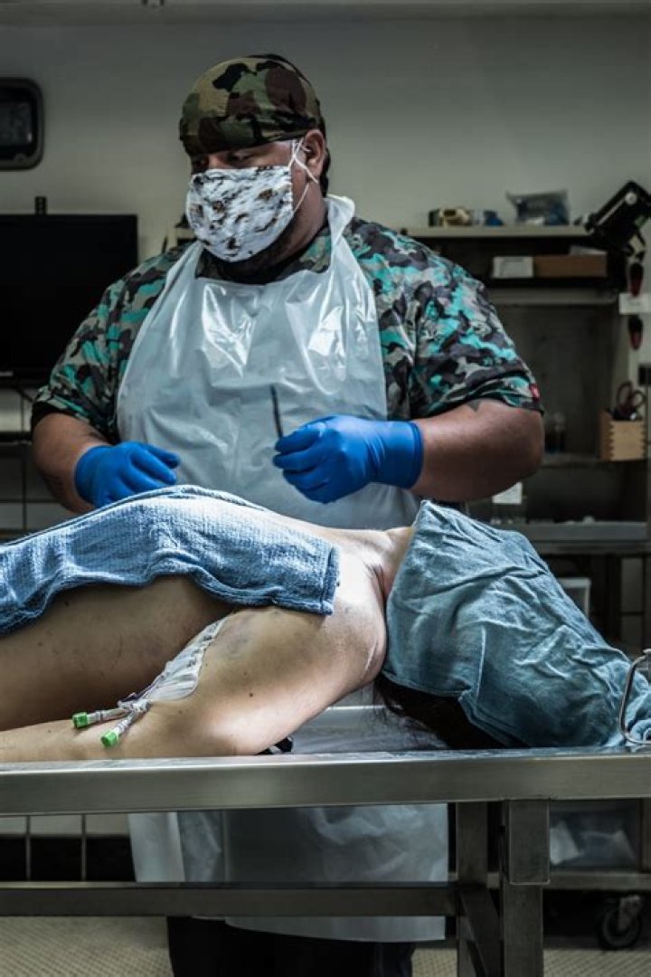 The Astonishing Autopsy Of Tarrare: A Medical Enigma
