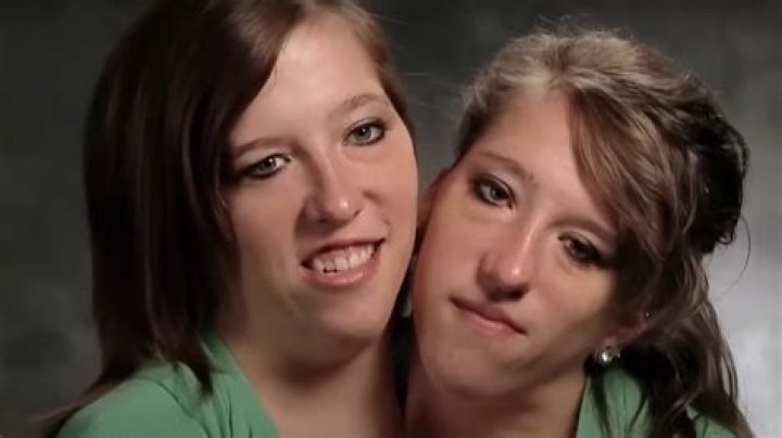 The Heartbreaking Family Tragedy Of Abby And Brittany Hensel