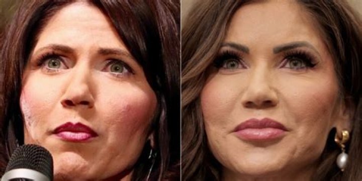 The Ultimate Guide To Kristi Noem's Plastic Surgery Journey