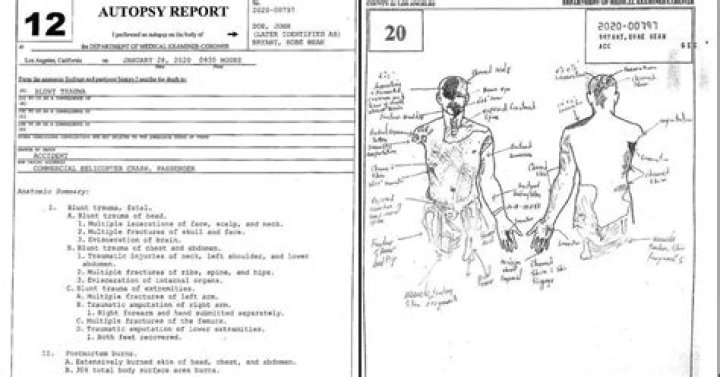 Tragic Details: The Autopsy Findings Of Gianna Bryant