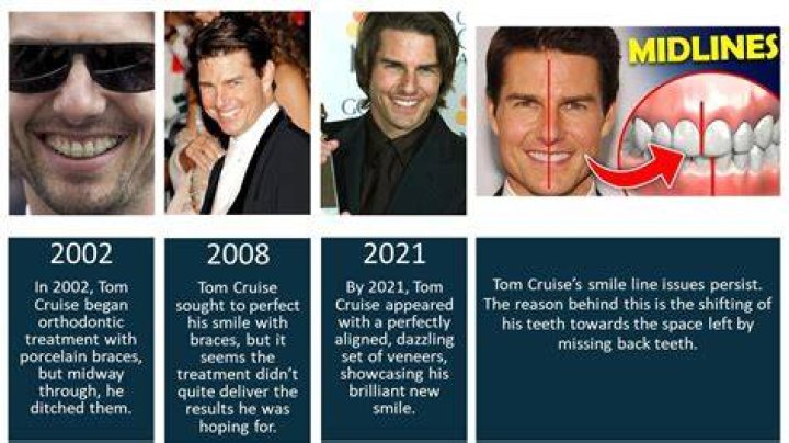 Uncover The Secrets Of Tom Cruise's Surgical Enhancements