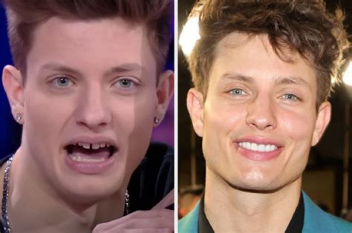 Unlock The Secrets Of Matt Rife's Captivating Smile