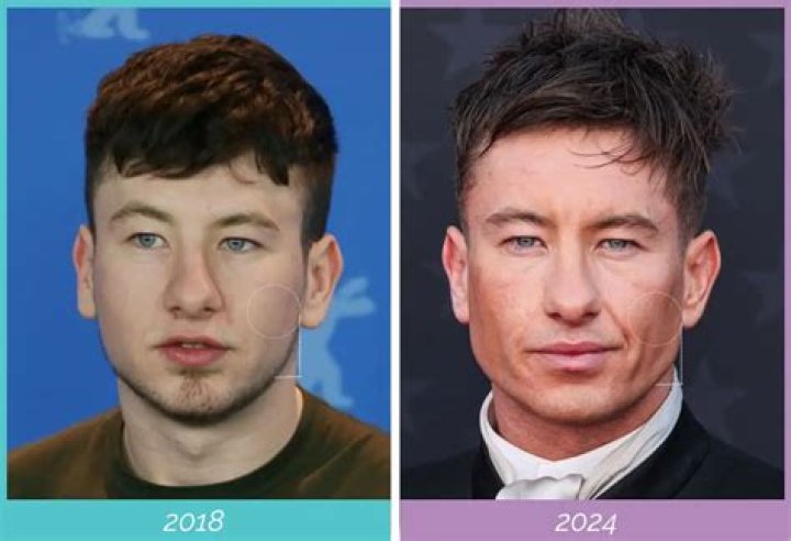 Unraveling Barry Keoghan's Ethnicity: Beyond The Surface