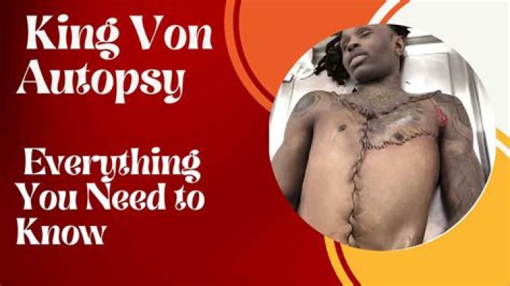 Unveiling King Vons Autopsy Results: A Deeper Dive