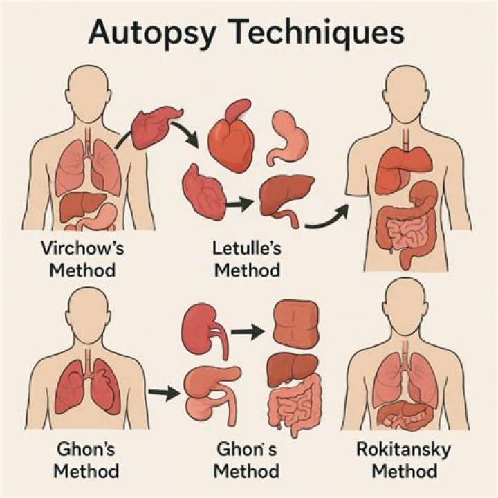 Unveiling Medical Mysteries: Tarrare's Organ Autopsy