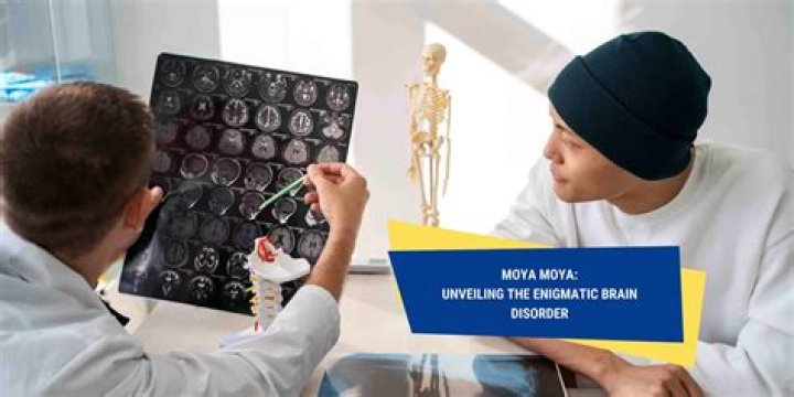 Unveiling The Intricacies Of Sherry Holmes Brain Tumor: Discoveries And Insights