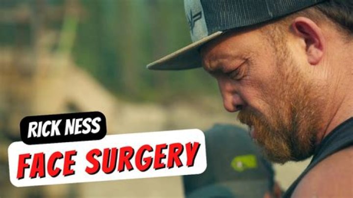 Unveiling The Secrets Of Rick Ness Face Surgery: Discoveries And Insights