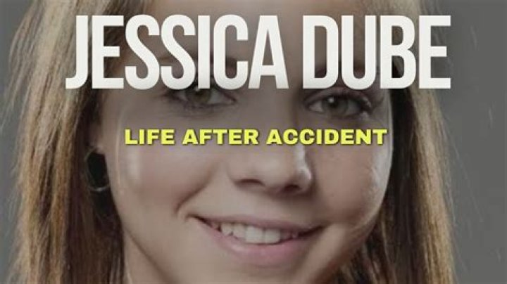 Unveiling The Truth Behind Jessica Dube's Injury Face: Discoveries And Insights