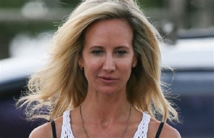 What Happened to Lady Victoria Hervey’s Face?
